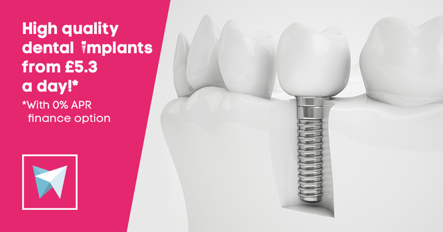 High quality dental implants from £5.3 a day!