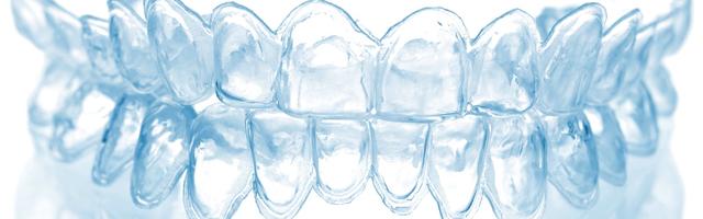 Tooth Whitening Costs