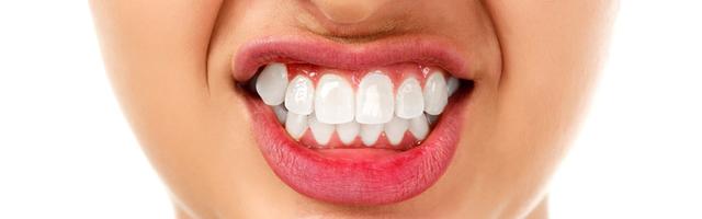 Switch Your Fillings