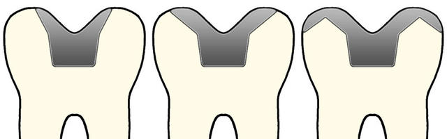 Il magico mondo dell’odontoiatria conservativa