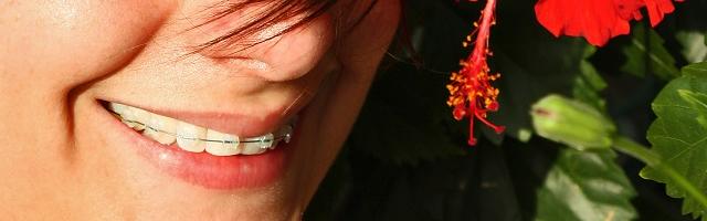 Braces Aren’t Just For Kids