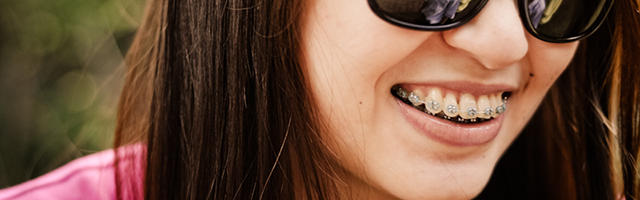 Tutto quello che avresti voluto sapere sull’ortodonzia (Parte seconda)