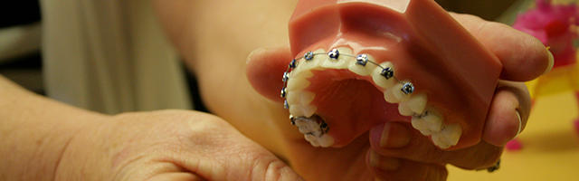 Breve storia sull’ortodonzia