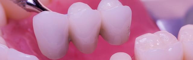 C’erano una volta i miei denti…