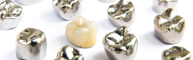 Corone dentali, quale corona scegliere?