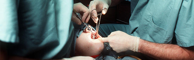 Routine Oral Surgical Procedures