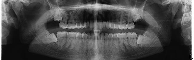 I terribili denti del giudizio