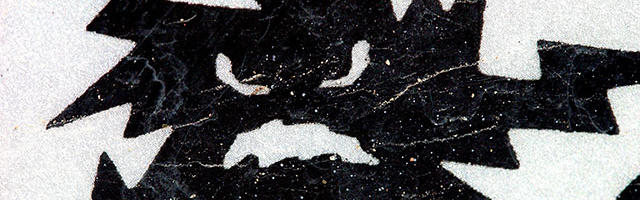 Problemi di sensibilita’ alla dentina