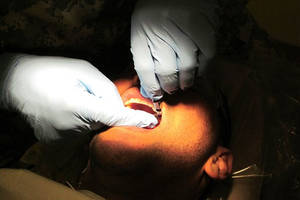 Estrazioni necessarie