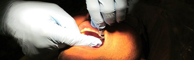 Estrazioni necessarie