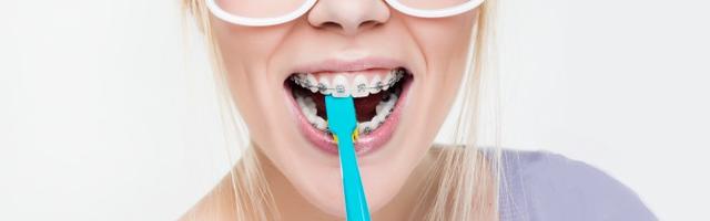 Carie dentale dopo il trattamento ortodontico