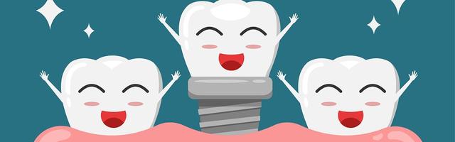 Impianti dentali: tutto cio’ che devi sapere