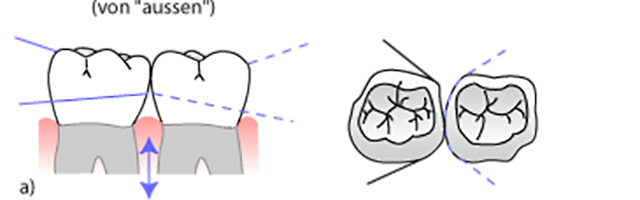 Il filo interdentale