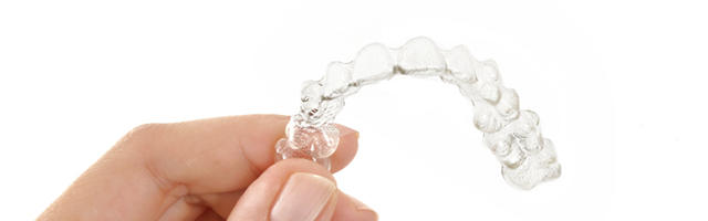 Ortodonzia: Invisalign® e Inman