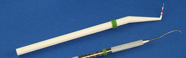 La malattia parodontale: cause e conseguenze sulla salute