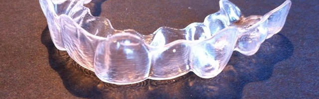 Ortodonzia invisibile