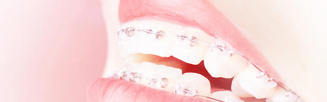 Tutto quello che avresti voluto sapere sull’ortodonzia (Parte prima)