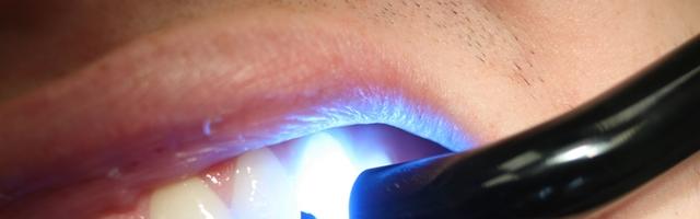 Otturazione Procedura