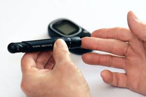 Il diabete e gli impianti dentalii