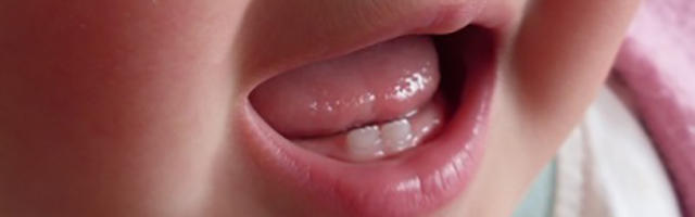 C’era una volta il primo dentino