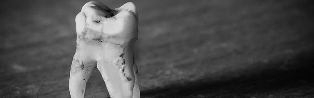 Denti sensibili: cause e trattamento