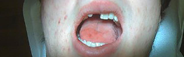 Che incubo sono rimasto senza denti!