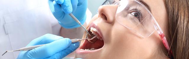 Che cos'è la parodontite?