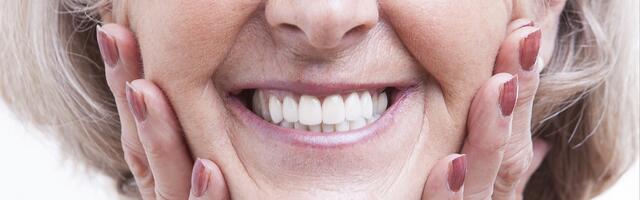 Sostituzione dei denti: protesi o ponte?