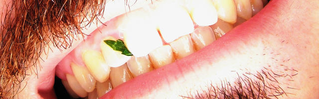 Rimozione del tartaro  - Ultrasuoni Vs Metodi convenzionali