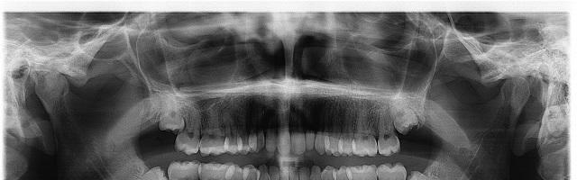 Denplan e lo studio odontoiatrico DENTISTA ITALIANO A LONDRA