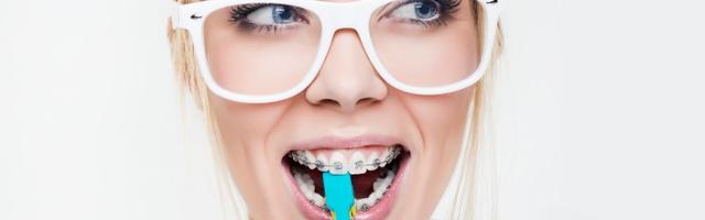 10 cose da sapere prima di cominciare un trattamento ortodontico – 1 parte