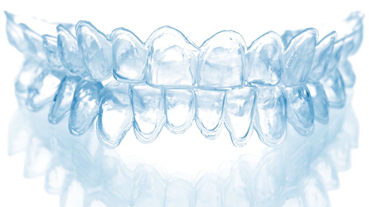 Tooth tray from a whitening kit