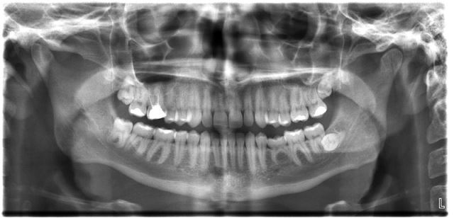 dental x-ray