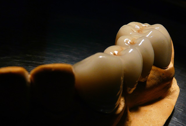 a king and his crown